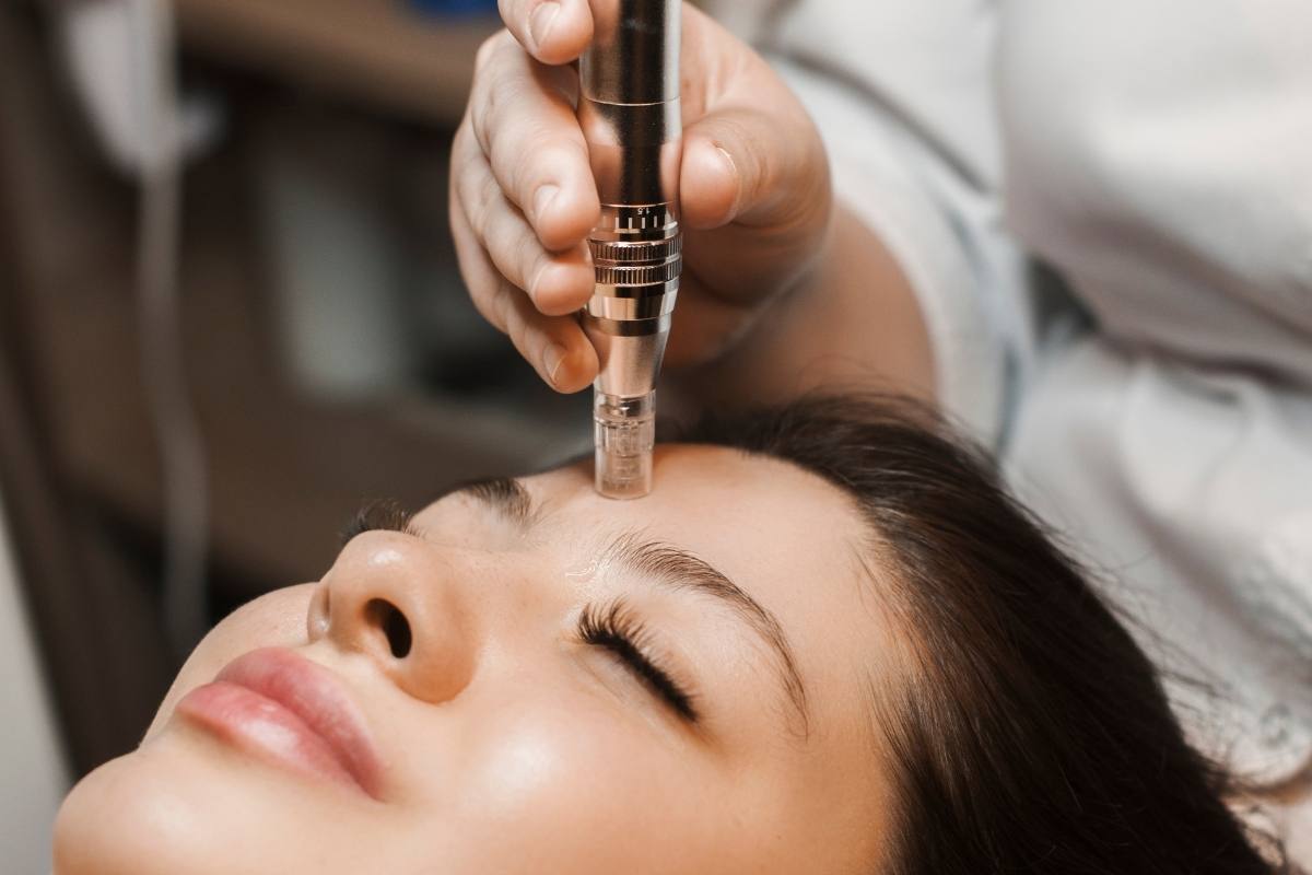 Your First Time Microneedling? Here’s What to Expect