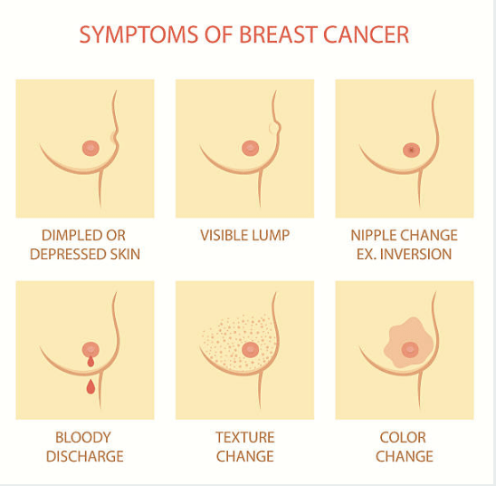 breast-cancer